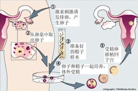 借卵代生包女孩代生包成功